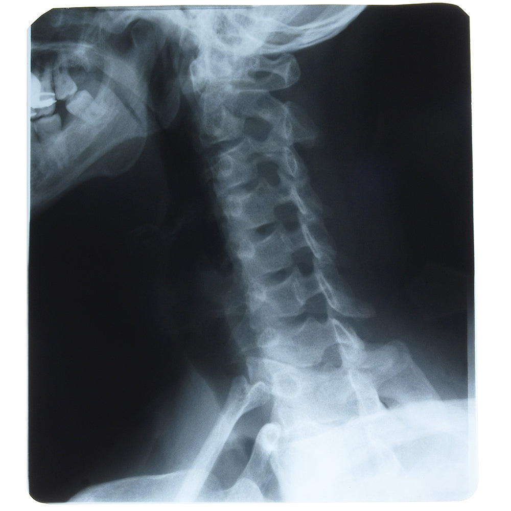 Full Speed X-Ray Film - Green